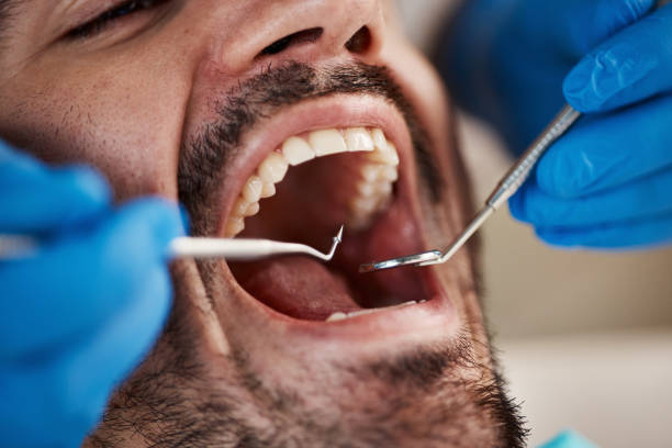 Best Emergency Dental Surgery in Columbia City, OR