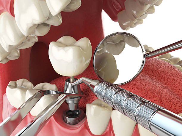 Best Walk-In Emergency Dentist in Columbia City, OR